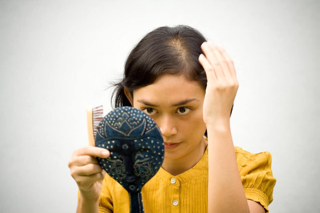 Hair Loss Dietary Causes