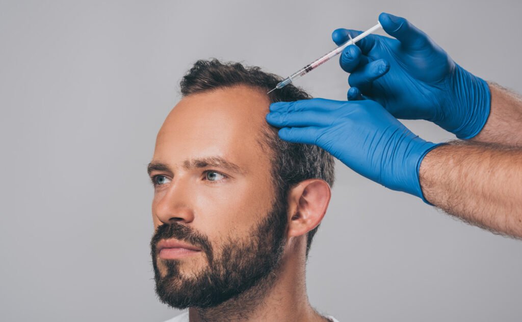 PRP shots for hair loss cost