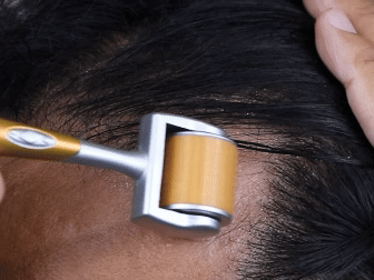 how to use derma roller