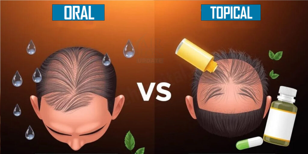Oral or Topical Minoxidil is effective